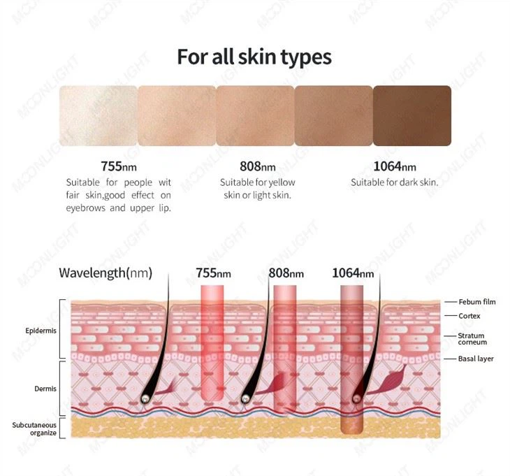 Medical Beauty Laser Soprano Titanium