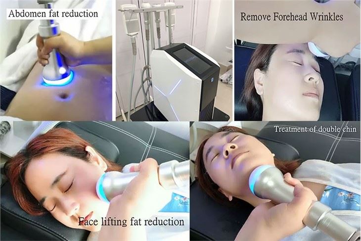 4 Handle Cryoskin Slimming Machine With EMS
