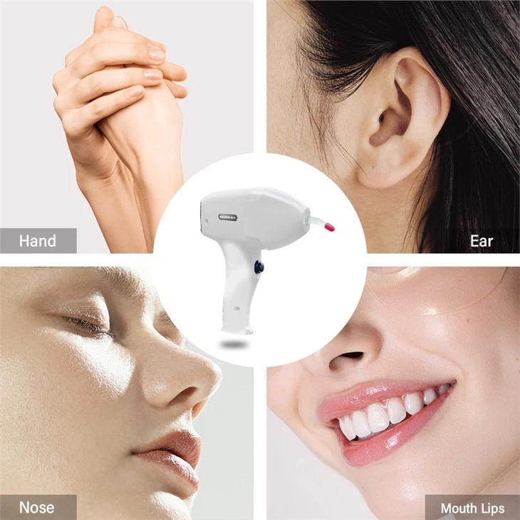 Alexandrite Laser Hair Removal