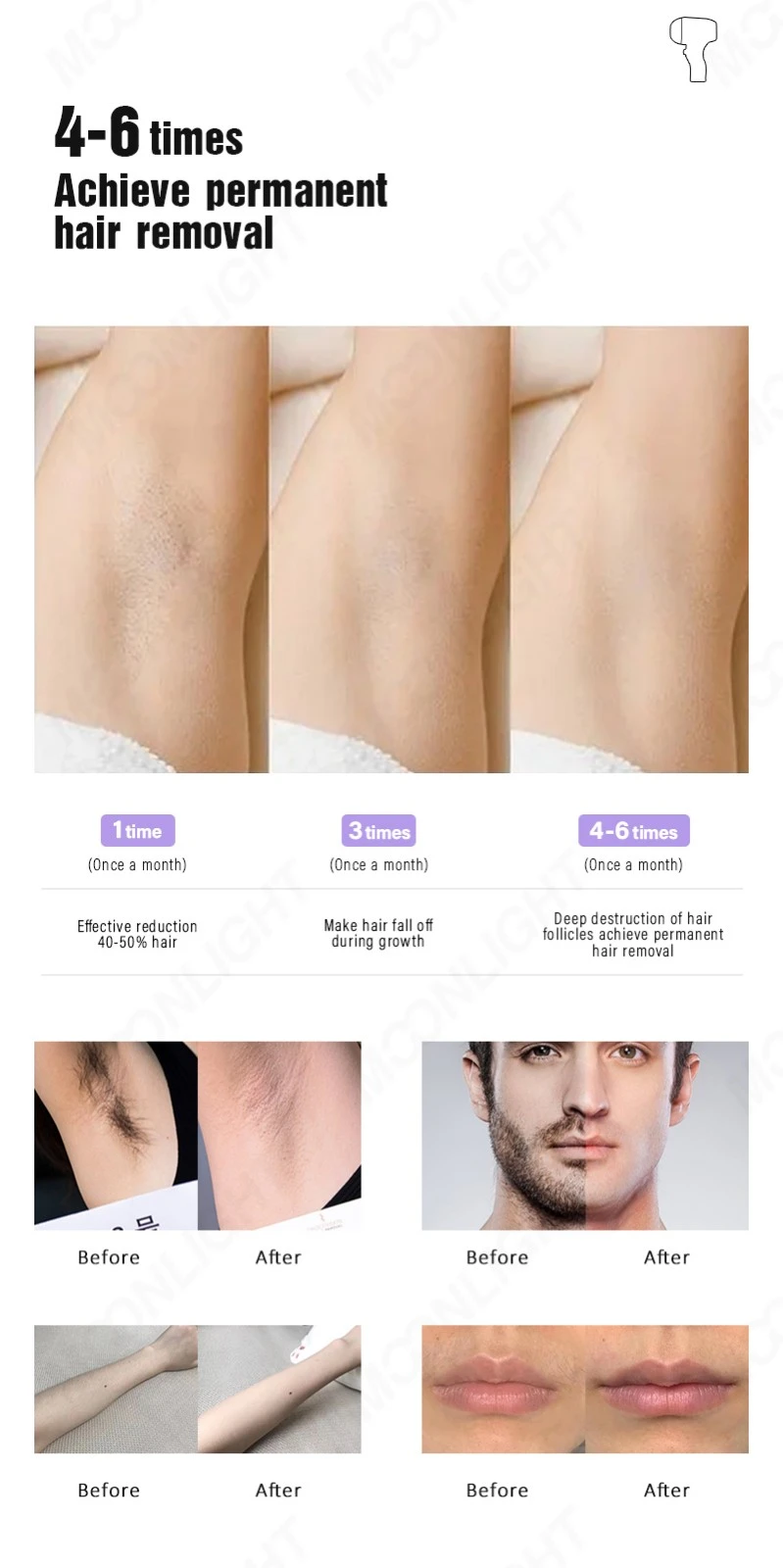 2026 AI-Enhanced Diode Laser Hair Removal Machine high quality