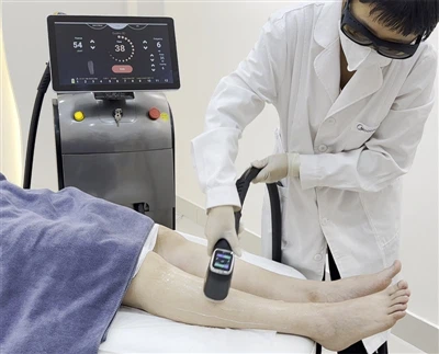 स्थायी बालों को हटाने के लिए सोप्रानो टाइटेनियम डायोड लेजर स्वर्ण मानक क्यों है?