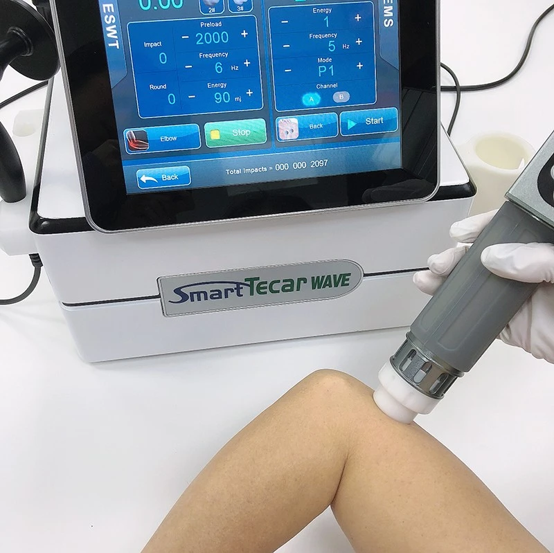 Smart Tecar Wave System best